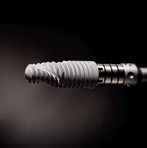 Implant po wyrwaniu zęba – kiedy można go wszczepić?